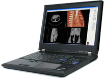Lenovo ThinkPad W701
