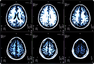 MRI Multi Scan
